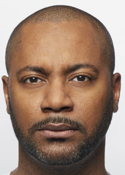 After Image: Dysport – Glabella – 2 - front
